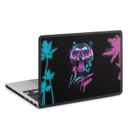 Hard Case for MacBook anthracite