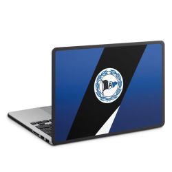 MacBook Case anthrazit