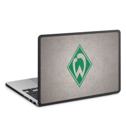MacBook Case anthrazit