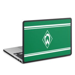 MacBook Case anthrazit