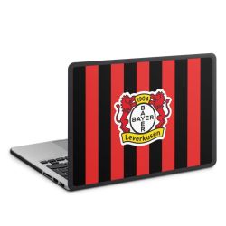 MacBook Case anthrazit