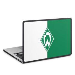 MacBook Case anthrazit