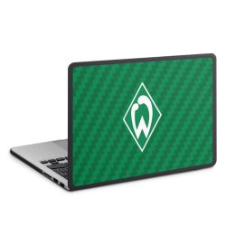 MacBook Case anthrazit