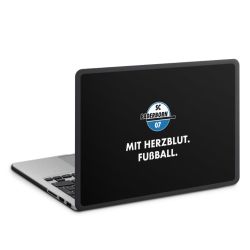 MacBook Case anthrazit