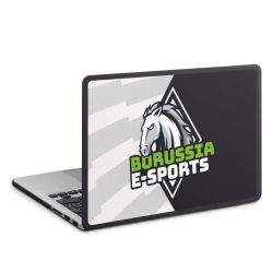 MacBook Case anthrazit