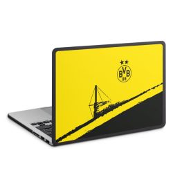 Hard Case for MacBook anthracite