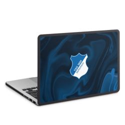 MacBook Case anthrazit