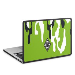 MacBook Case anthrazit