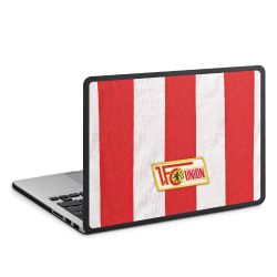 Hard Case für MacBook anthrazit