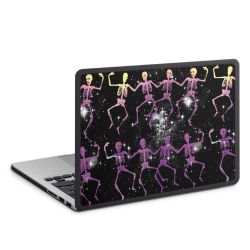 Hard Case for MacBook anthracite