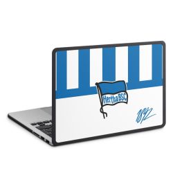 Hard Case für MacBook anthrazit