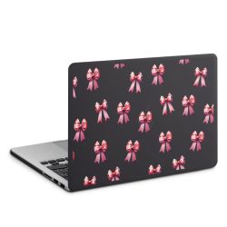 Hard Case für MacBook anthrazit