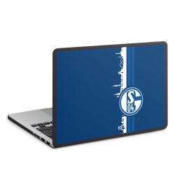 MacBook Case anthracite