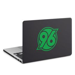 MacBook Case anthrazit