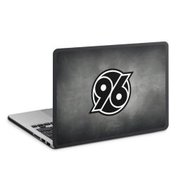 Hard Case für MacBook anthrazit