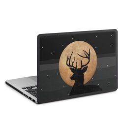 Hard Case for MacBook anthracite