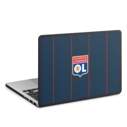 MacBook Case anthracite