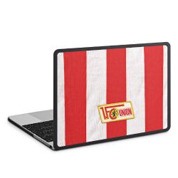 Hard Case für MacBook anthrazit