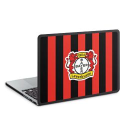 Hard Case für MacBook anthrazit