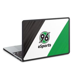 Hard Case für MacBook anthrazit