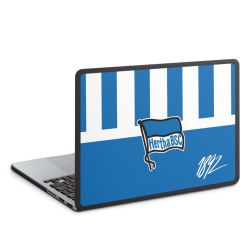 Hard Case für MacBook anthrazit