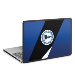 MacBook Case anthrazit