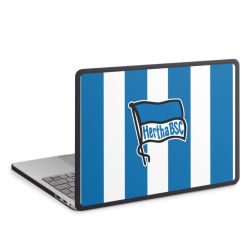 MacBook Case anthrazit