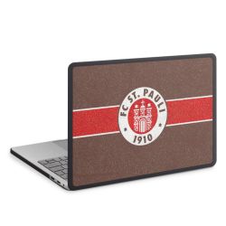 MacBook Case anthrazit
