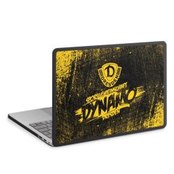 MacBook Case anthrazit