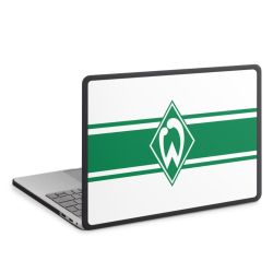 MacBook Case anthrazit