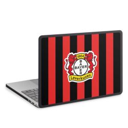 MacBook Case anthrazit