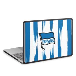 MacBook Case anthrazit