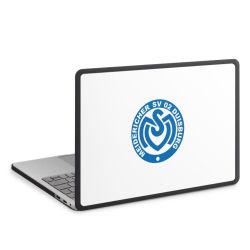 MacBook Case anthrazit