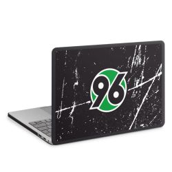 MacBook Case anthrazit