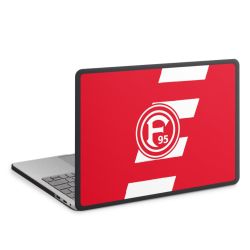 MacBook Case anthrazit