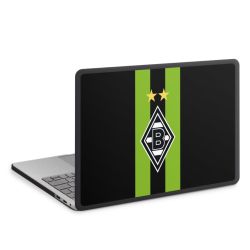 MacBook Case anthrazit