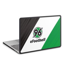 MacBook Case anthrazit