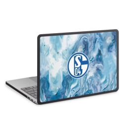 MacBook Case anthrazit