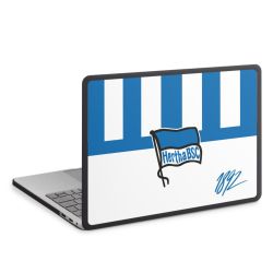 MacBook Case anthrazit