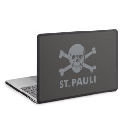MacBook Case anthrazit
