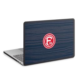 MacBook Case anthrazit