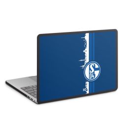 MacBook Case anthracite