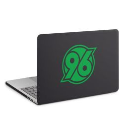 MacBook Case anthrazit