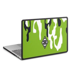 MacBook Case anthrazit