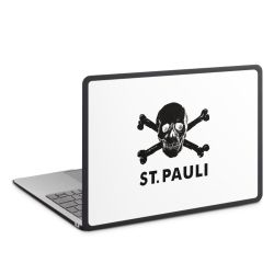 Hard Case für MacBook anthrazit