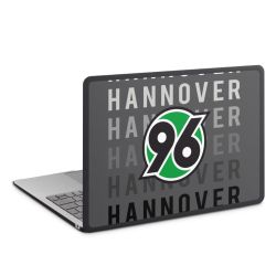 Hard Case für MacBook anthrazit