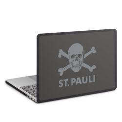 MacBook Case anthrazit