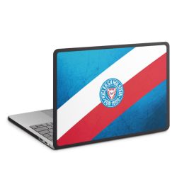 MacBook Case anthrazit