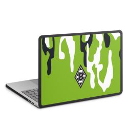 MacBook Case anthrazit