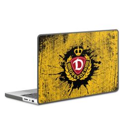 Hard Case für MacBook anthrazit